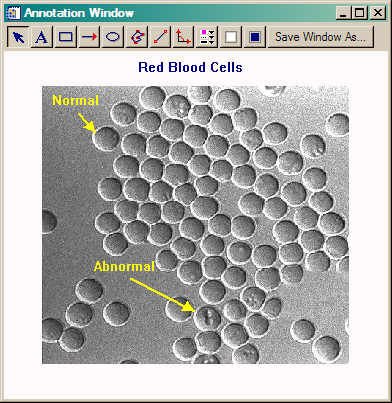 The AnnotateWindow program.